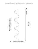 BREATHING CONTROL USING HIGH FLOW RESPIRATION ASSISTANCE diagram and image