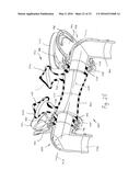 PATIENT INTERFACE DEVICE WITH LIMITED SUPPORT AREA ON THE FACE diagram and image