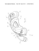 PATIENT INTERFACE DEVICE WITH LIMITED SUPPORT AREA ON THE FACE diagram and image