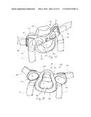 PATIENT INTERFACE DEVICE WITH LIMITED SUPPORT AREA ON THE FACE diagram and image