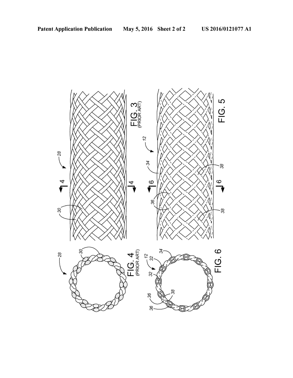 Braid Plating For Torsional Stiffness - diagram, schematic, and image 03