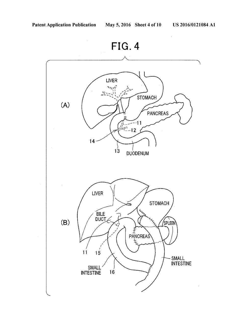 Method for inserting endoscopic device into hollow organ using guide wire - diagram, schematic, and image 05