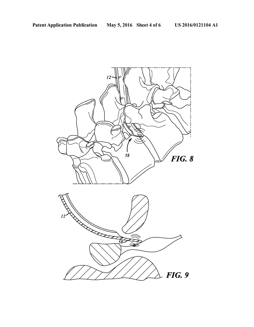 SURGICAL DEVICE - diagram, schematic, and image 05