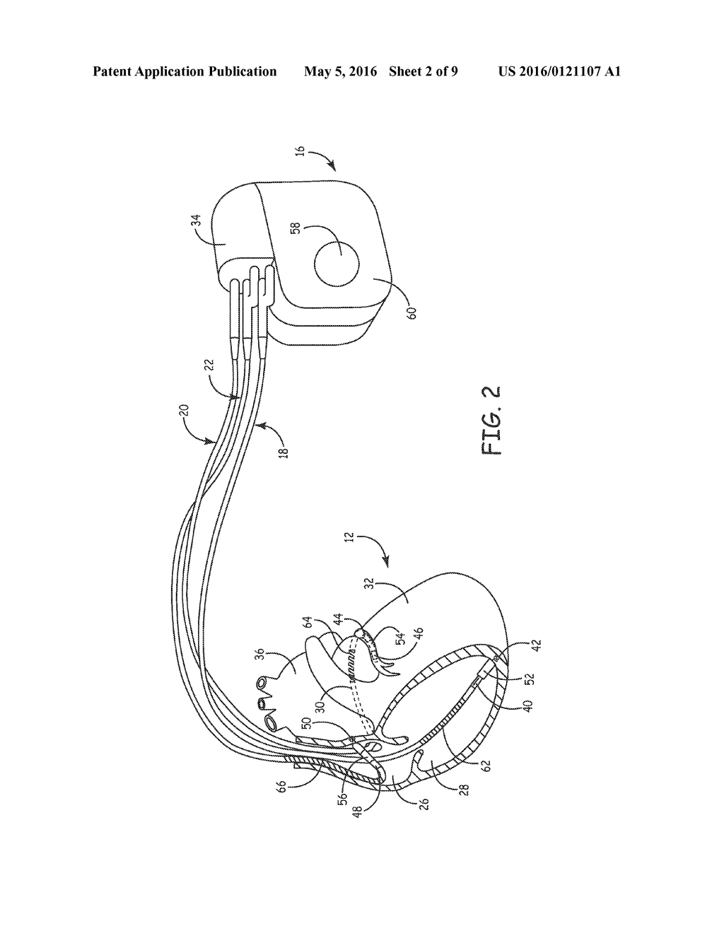 METHOD AND APPARATUS TO MANAGE LEAD-RELATED CONDITIONS FOR FAULT TOLERANCE     ENHANCEMENTS - diagram, schematic, and image 03