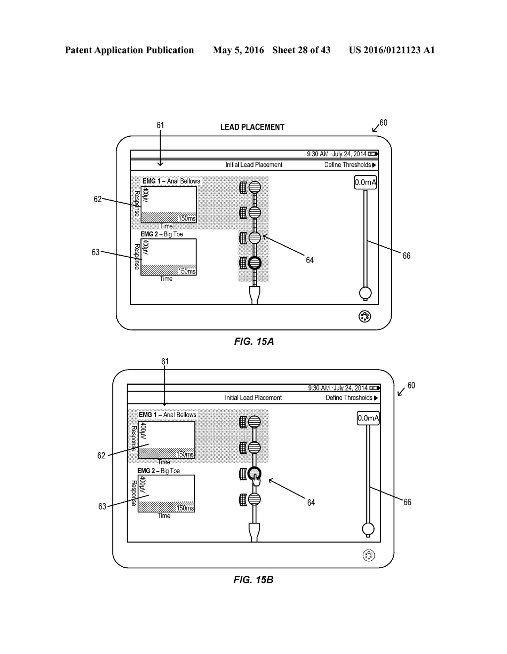 Electromyographic Lead Positioning and Stimulation Titration in a Nerve     Stimulation System for Treatment of Overactive Bladder - diagram, schematic, and image 29