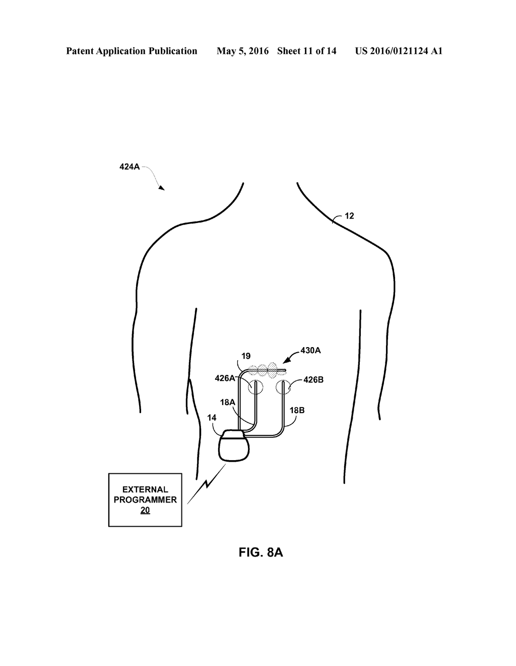 PAIRED STIMULATION PULSES BASED ON SENSED COMPOUND ACTION POTENTIAL - diagram, schematic, and image 12