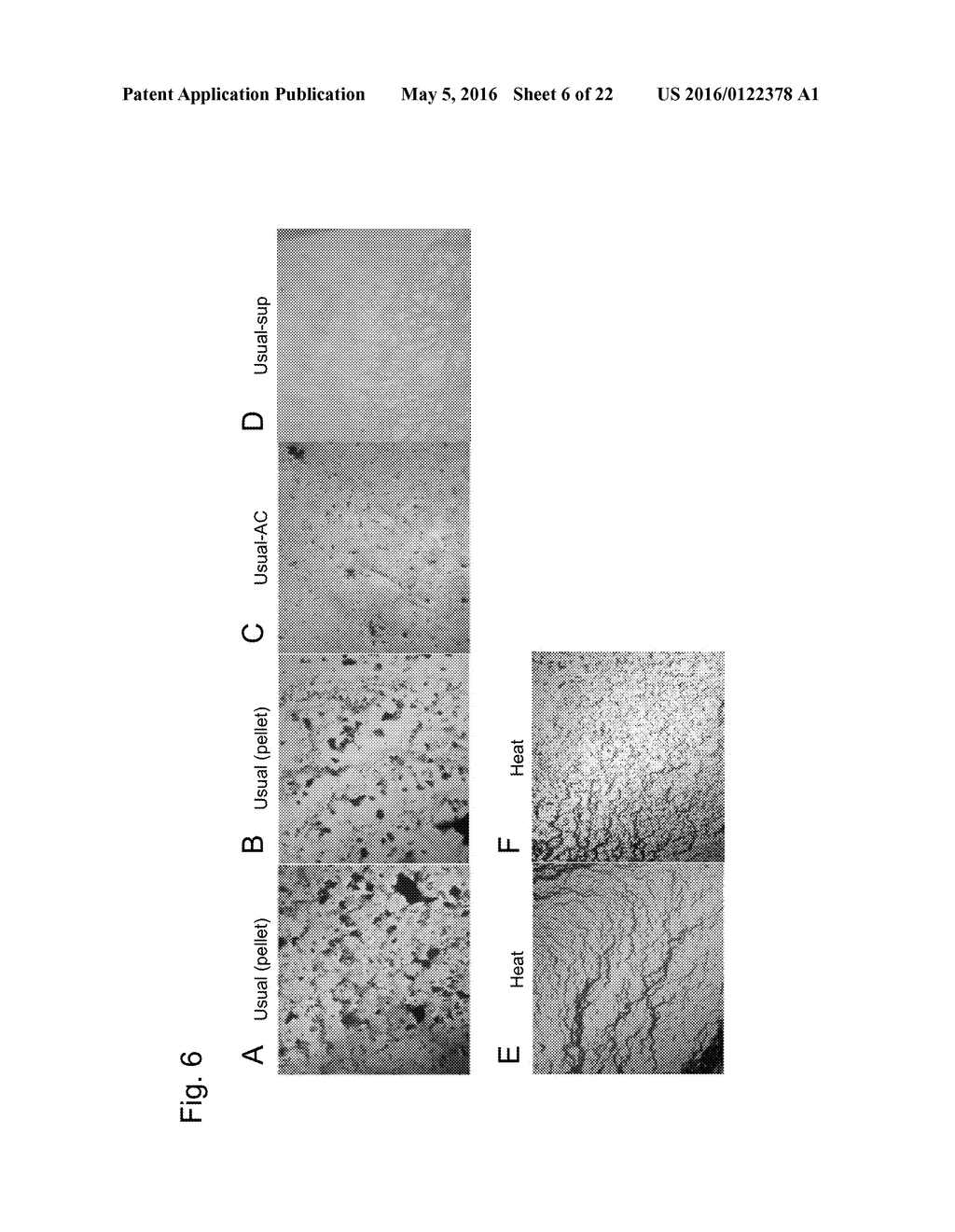 METHOD FOR PRODUCING BETA-HEMATIN CRYSTAL COMPRISING STEP OF HEATING - diagram, schematic, and image 07