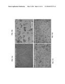 GENERATION OF CYTOTOXIC TUMOR SPECIFIC CELL LINES AND USES THEREOF diagram and image