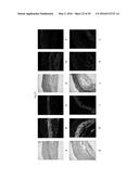 ENGINEERED THREE-DIMENSIONAL SKIN TISSUES, ARRAYS THEREOF, AND METHODS OF     MAKING THE SAME diagram and image