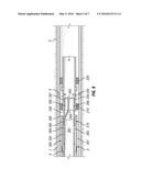 Straddle Packer Equalization and Self Recovery Module diagram and image