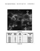 METHODS FOR STRATIFYING NON-RESPONDERS TO THERAPIES THAT BLOCK PD1/PDL1     AXIS diagram and image