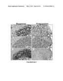 METHODS FOR STRATIFYING NON-RESPONDERS TO THERAPIES THAT BLOCK PD1/PDL1     AXIS diagram and image