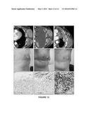 METHODS FOR STRATIFYING NON-RESPONDERS TO THERAPIES THAT BLOCK PD1/PDL1     AXIS diagram and image