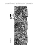 METHODS FOR STRATIFYING NON-RESPONDERS TO THERAPIES THAT BLOCK PD1/PDL1     AXIS diagram and image