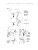 Obtaining an Improved Therapeutic Ligand diagram and image