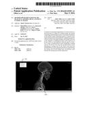 METHOD FOR SEGMENTATION OF THE HEAD-NECK ARTERIES, BRAIN AND SKULL IN     MEDICAL IMAGES diagram and image