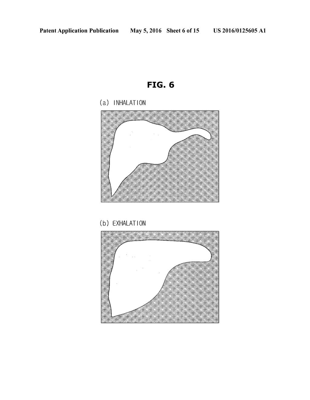 IMAGE PROCESSING APPARATUS, IMAGE PROCESSING METHOD, AND ULTRASOUND     IMAGING APPARATUS HAVING IMAGE PROCESSING UNIT - diagram, schematic, and image 07