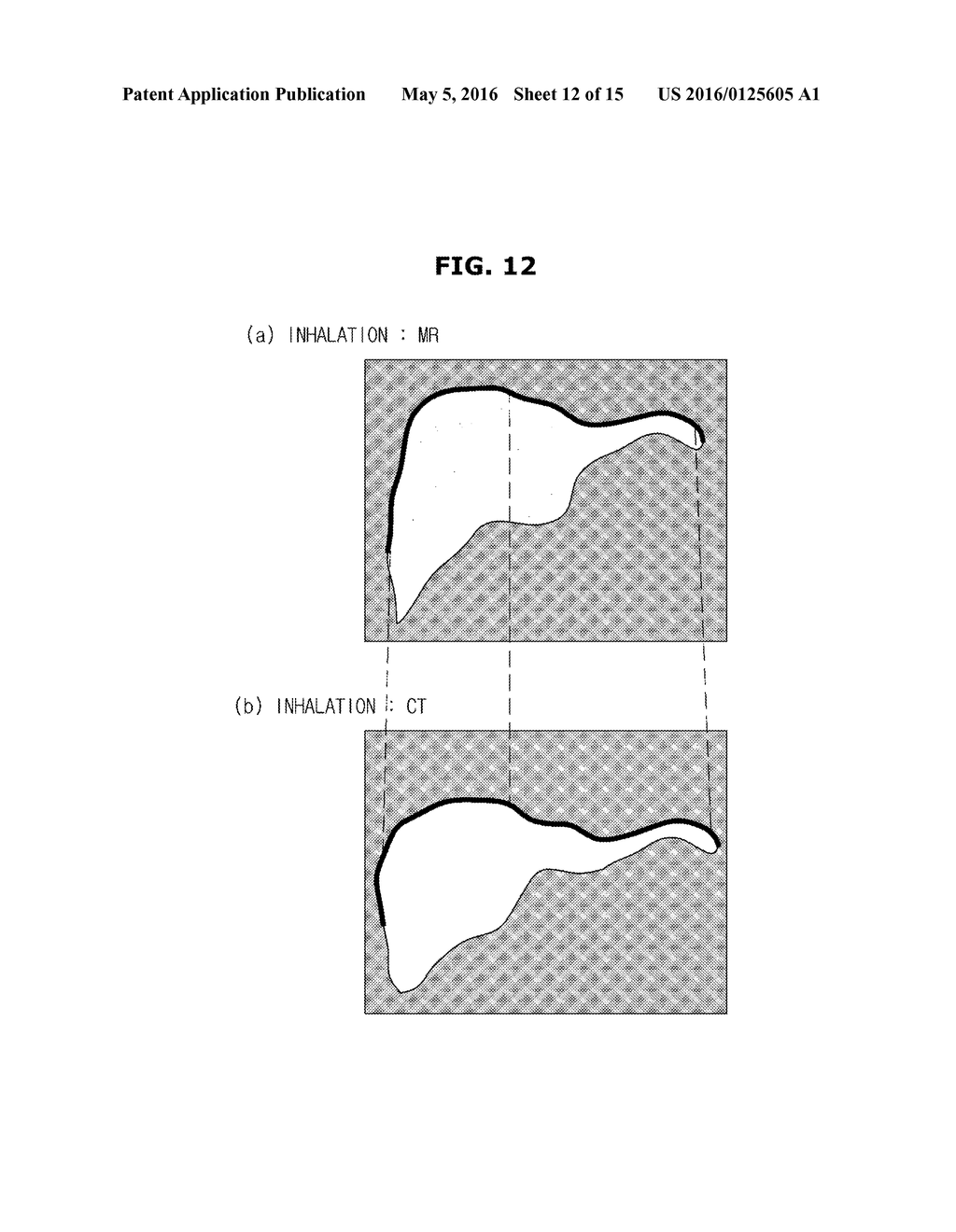 IMAGE PROCESSING APPARATUS, IMAGE PROCESSING METHOD, AND ULTRASOUND     IMAGING APPARATUS HAVING IMAGE PROCESSING UNIT - diagram, schematic, and image 13