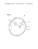 OPTICAL TOMOGRAPHY DEVICE diagram and image