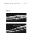 OPTICAL TOMOGRAPHY DEVICE diagram and image