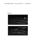 OPTICAL TOMOGRAPHY DEVICE diagram and image