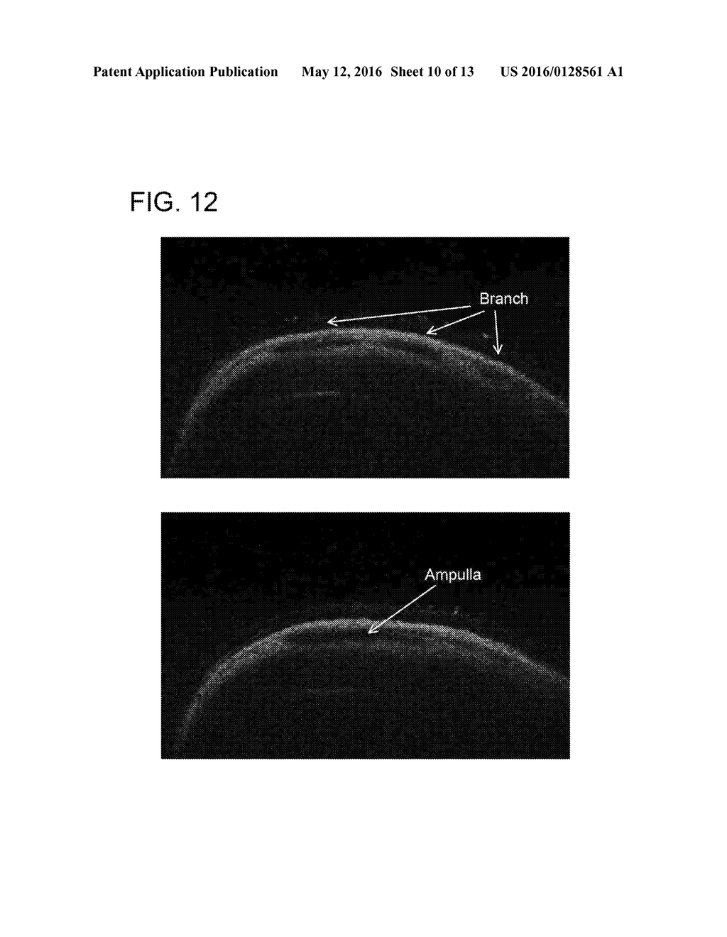 OPTICAL TOMOGRAPHY DEVICE - diagram, schematic, and image 11