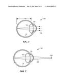 Apparatus and Method of Determining an Eye Prescription diagram and image