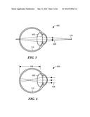 Apparatus and Method of Determining an Eye Prescription diagram and image