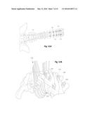 IMPLANTABLE SENSORS AND METHODS OF USE diagram and image