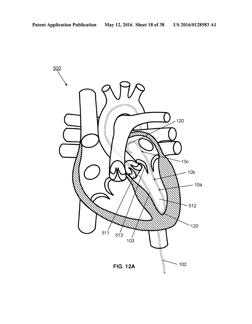 SYSTEM AND APPARATUS COMPRISING A MULTISENSOR GUIDEWIRE FOR USE IN     INTERVENTIONAL CARDIOLOGY - diagram, schematic, and image 19