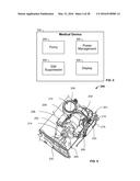 Medical Device diagram and image