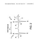 MEANS AND METHOD FOR THE DETECTION OF CARDIAC EVENTS diagram and image