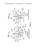 MEANS AND METHOD FOR THE DETECTION OF CARDIAC EVENTS diagram and image