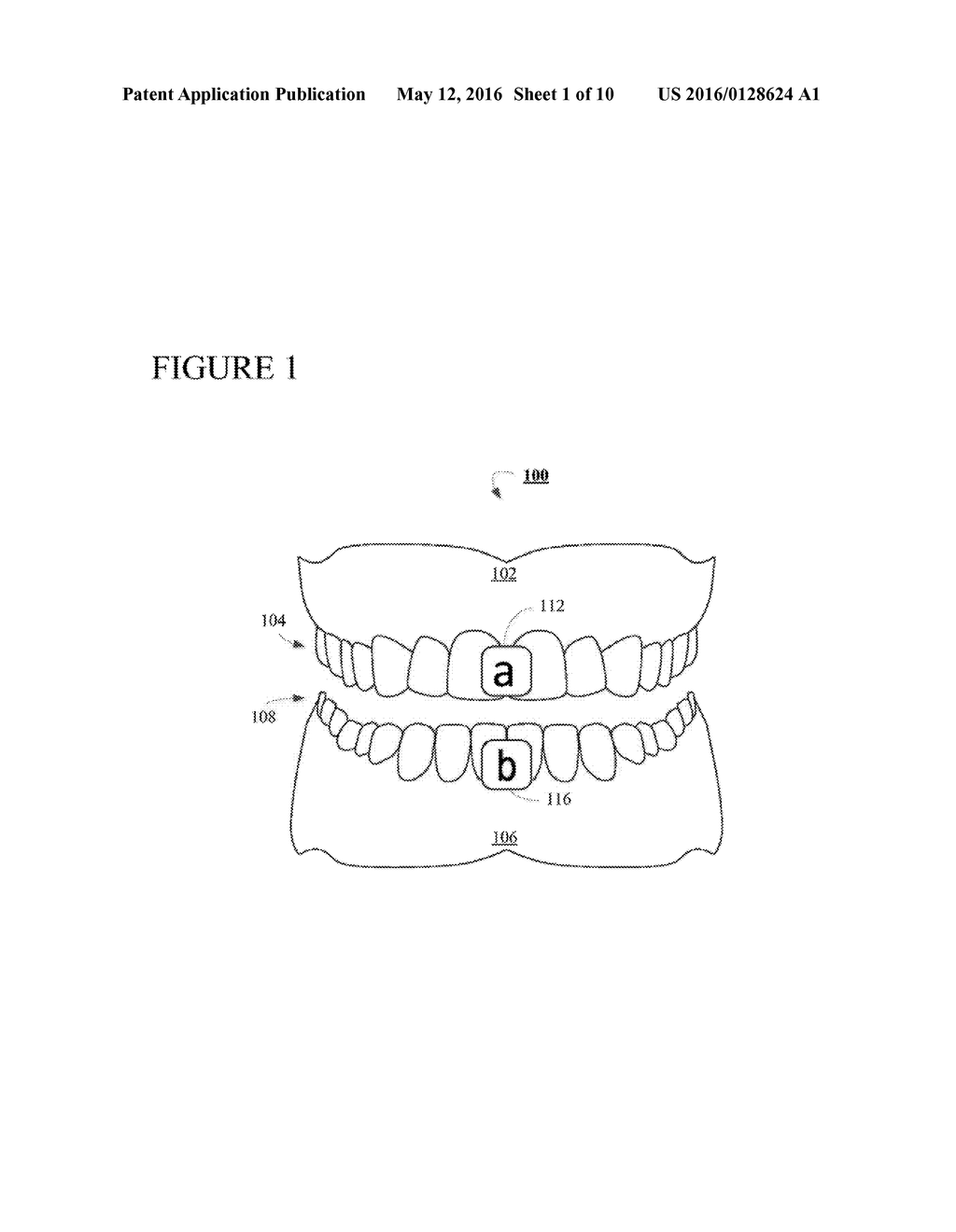 THREE DIMENSIONAL IMAGING OF THE MOTION OF TEETH AND JAWS - diagram, schematic, and image 02