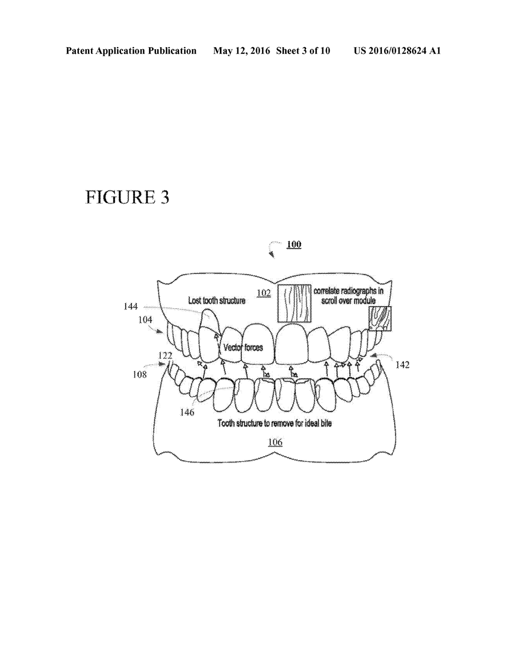 THREE DIMENSIONAL IMAGING OF THE MOTION OF TEETH AND JAWS - diagram, schematic, and image 04