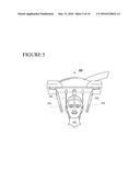 THREE DIMENSIONAL IMAGING OF THE MOTION OF TEETH AND JAWS diagram and image