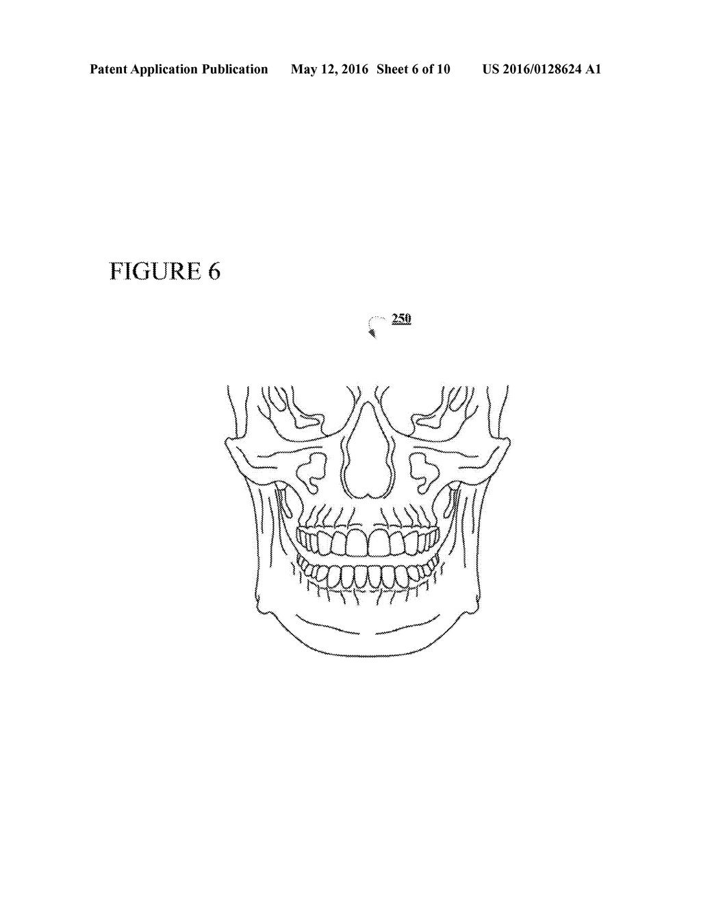 THREE DIMENSIONAL IMAGING OF THE MOTION OF TEETH AND JAWS - diagram, schematic, and image 07