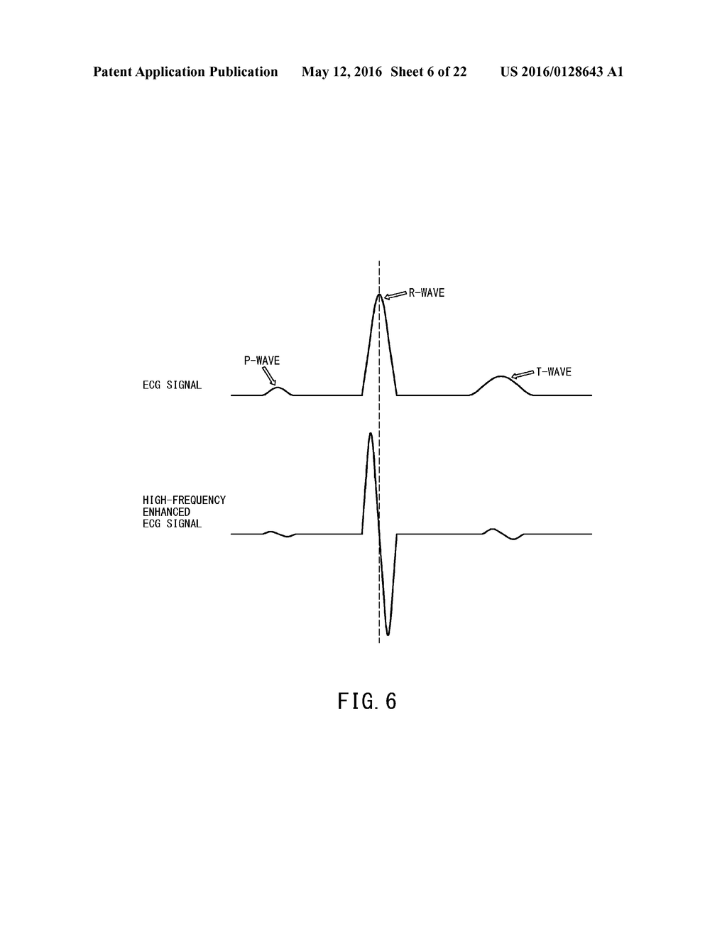 SIGNAL PROCESSING APPARATUS, IMAGING APPARATUS, AND SIGNAL PROCESSING     METHOD - diagram, schematic, and image 07