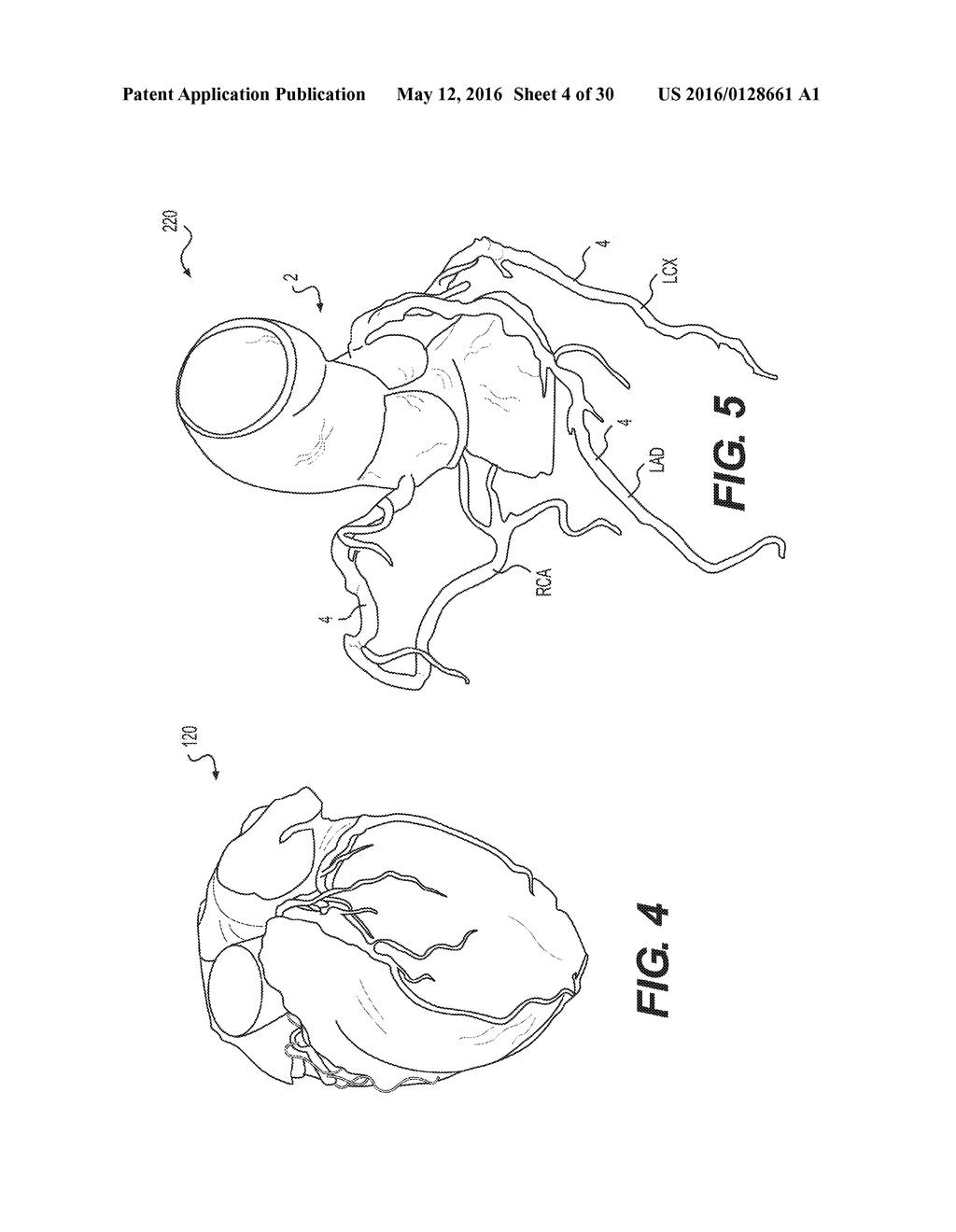 METHOD AND SYSTEM FOR IMAGE PROCESSING TO DETERMINE PATIENT-SPECIFIC BLOOD     FLOW CHARACTERISTICS - diagram, schematic, and image 05