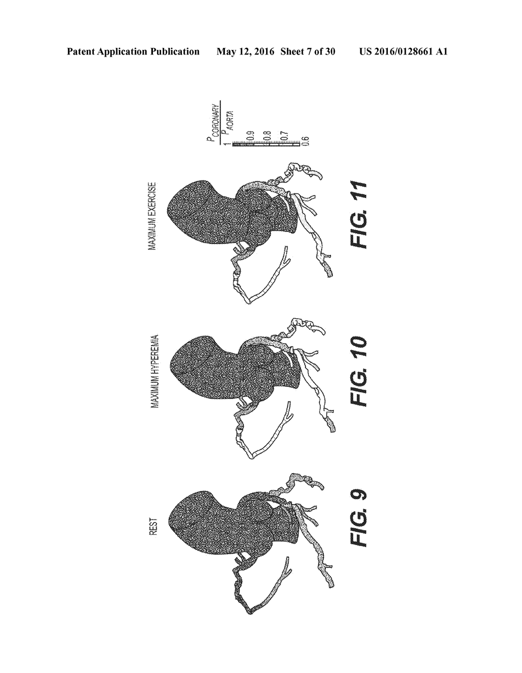 METHOD AND SYSTEM FOR IMAGE PROCESSING TO DETERMINE PATIENT-SPECIFIC BLOOD     FLOW CHARACTERISTICS - diagram, schematic, and image 08