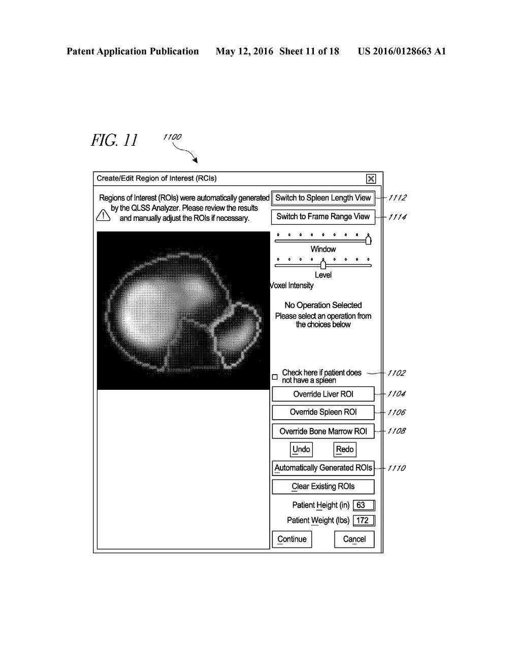 SYSTEMS AND METHODS FOR DETERMINING HEPATIC FUNCTION FROM LIVER SCANS - diagram, schematic, and image 12