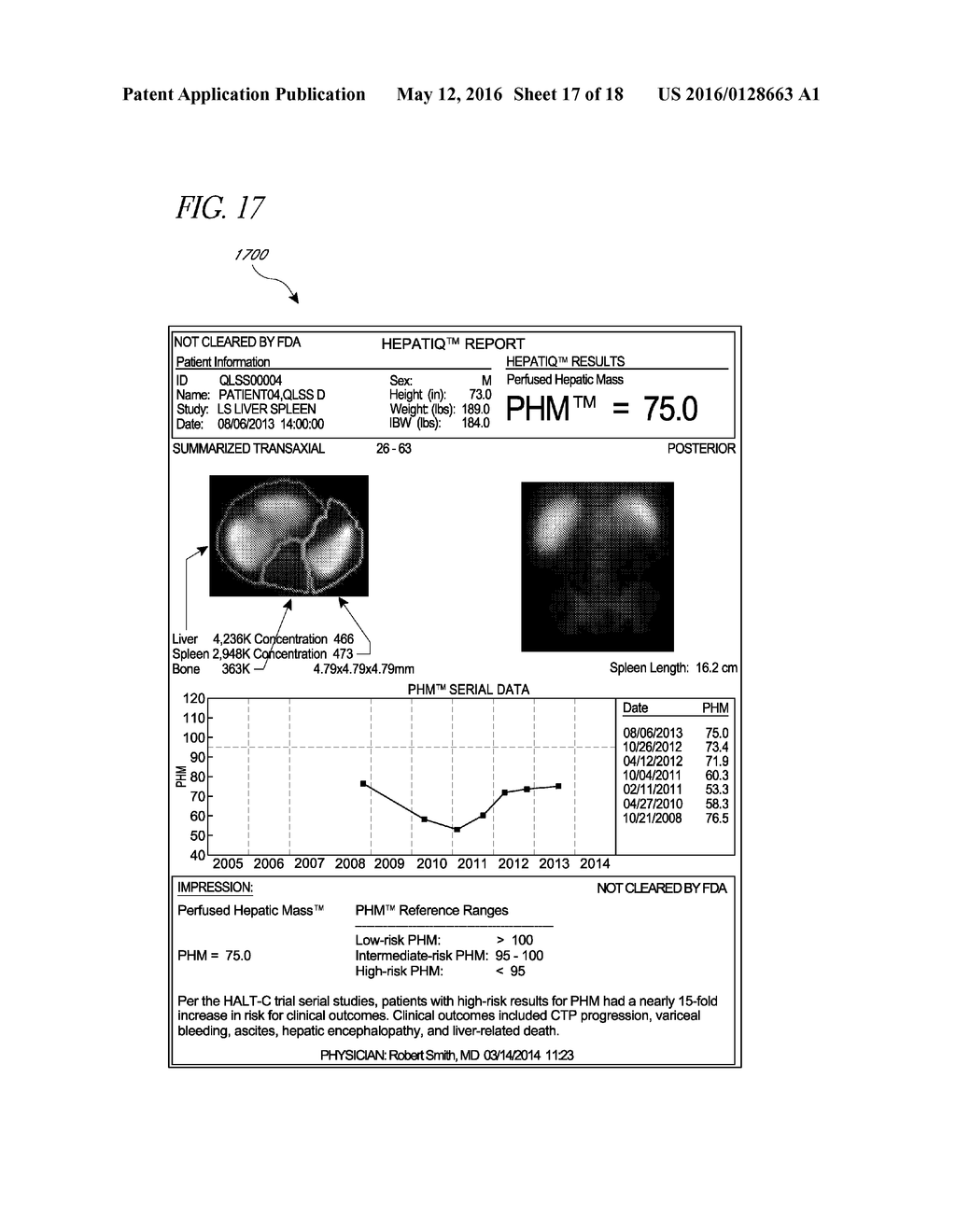 SYSTEMS AND METHODS FOR DETERMINING HEPATIC FUNCTION FROM LIVER SCANS - diagram, schematic, and image 18