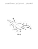 LOCKING MECHANISM FOR ULTRASOUND CONDUCTIVE MEDIUM diagram and image