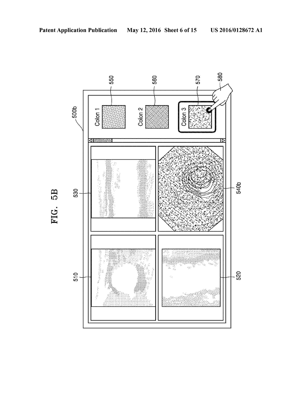 ULTRASOUND DIAGNOSIS APPARATUS AND METHOD - diagram, schematic, and image 07