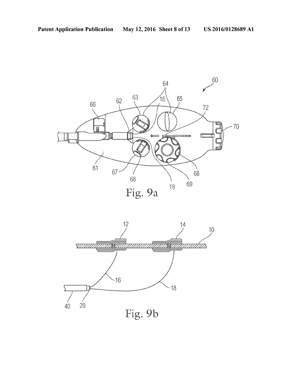 Plication Lock Delivery System and Method of Use Thereof - diagram, schematic, and image 09