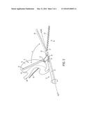 GASTRIC TRACTION DEVICE AND METHOD diagram and image