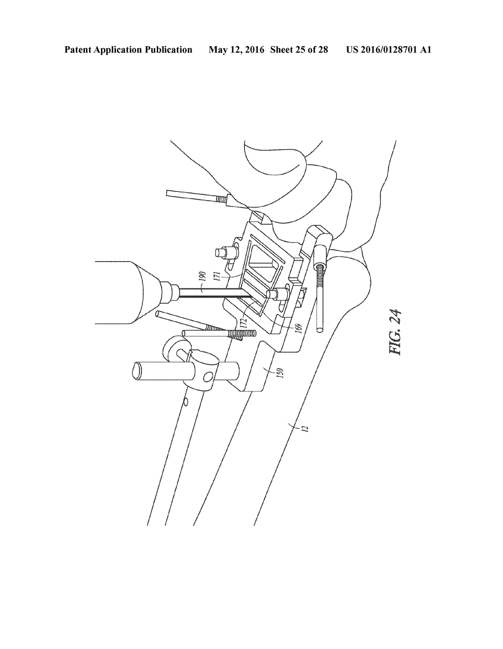POROUS SPACERS, INSTRUMENTS, AND METHODS FOR FOOT AND ANKLE FUSION - diagram, schematic, and image 26