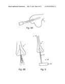 DISTAL FEMORAL JIG ASSEMBLY diagram and image