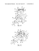 DISTAL FEMORAL JIG ASSEMBLY diagram and image