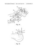 DISTAL FEMORAL JIG ASSEMBLY diagram and image